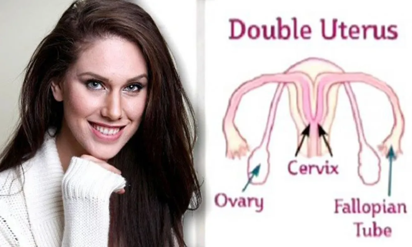 The Woman with a Double Uterus